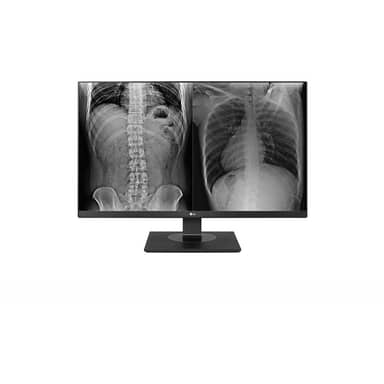 27" 3840 x 2160 IPS Panel Medical Monitor